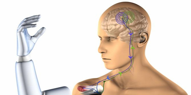 A végtagpótlásban segíthet a mesterséges intelligencia