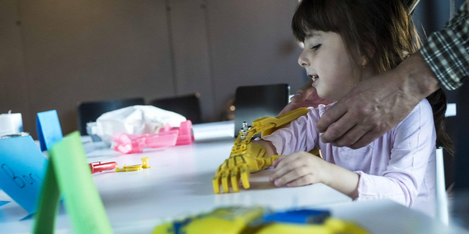 Magyar gyerekek is kaptak 3D-nyomtatott művégtagot