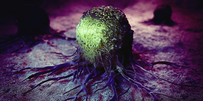 10 kilós tumor nőtt a férfi vállára: Fotók!