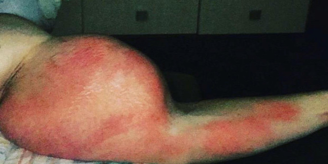 Egy orosz katona óriásira duzzasztotta karjait: fotó