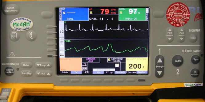 A defibrilláció szívleállásnál megduplázhatja a túlélési esélyeket