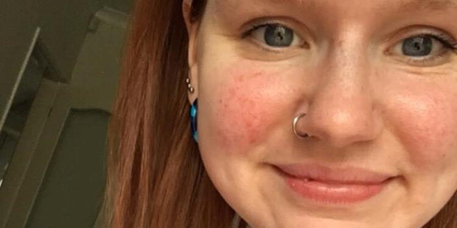 Vicky Whitingot furcsa dolgot borították ki, kiderült, hogy autista