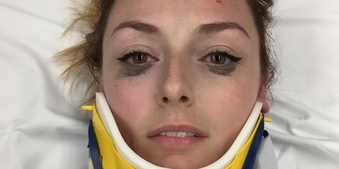Shelby Pagan sminkje egy autóbaleset után is tökéletes maradt, értékelte a terméket