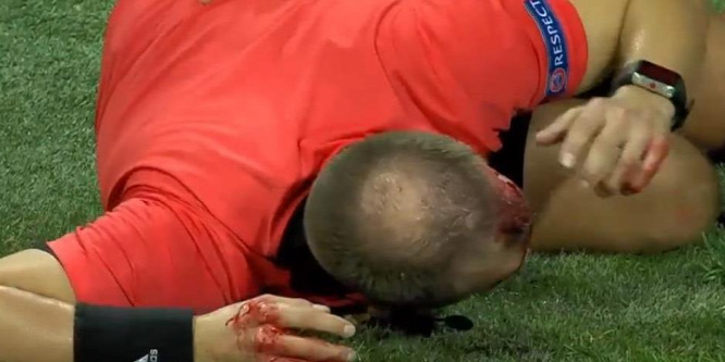 Véres jelenetek Grazban, fejbe dobták a partjelzőt - videó