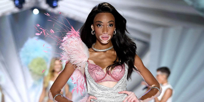Ledobta ruháit Winnie Harlow – Fotó