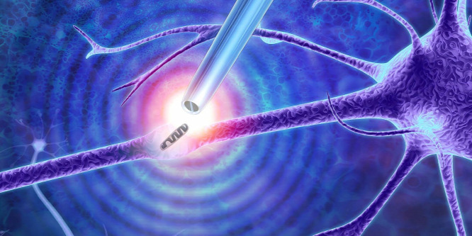 Nanocsipesszel fognak turkálni a sejtjeinkben