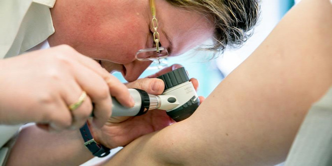 A rettegett melanoma odafigyeléssel megelőzhető