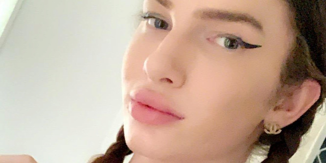 Úgy elrontották a plasztikai sebészek a transznemű vlogger orrát, hogy alig kap levegőt