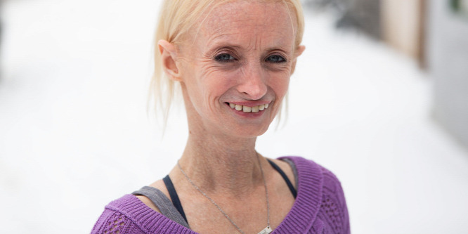 Tiffany Wedekind nyolcszor gyorsabban öregszik, mint az egészséges emberek