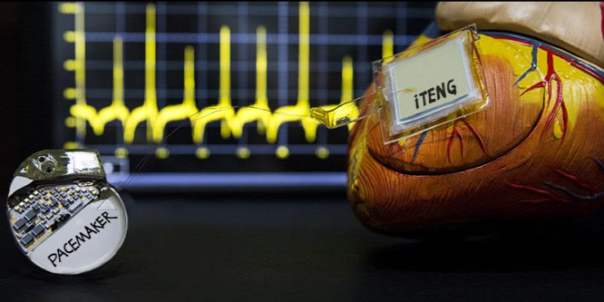Itt a szívverés energiájával működő pacemaker