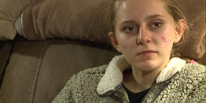 Caitlin Little emlékezete minden este törlődik: az orvosok is tanácstalanok