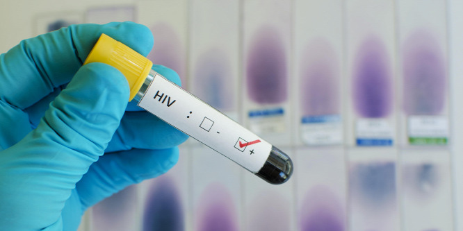A szakemberek szerint nem lehet védőoltást kifejleszteni a HIV ellen