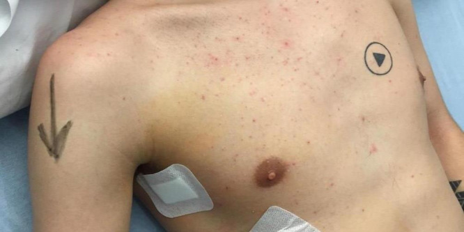 Megzavarta a sebészeket a tetoválás, majdnem tragédia lett belőle