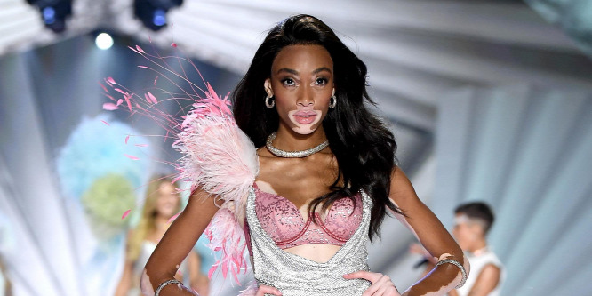 Szexi képeken feszít a medence partján a vitiligós modell, Winnie Harlow – Fotók