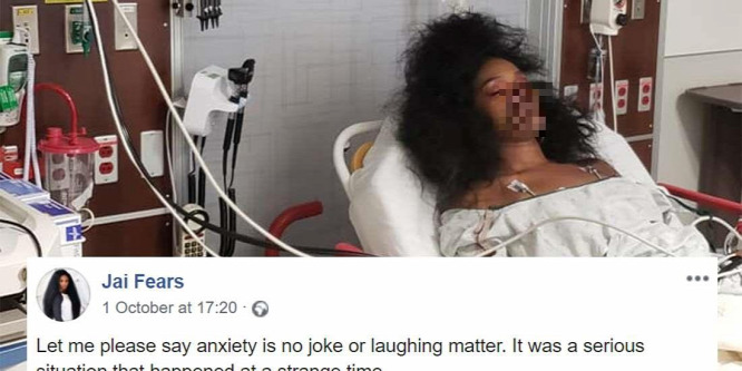 Horrorsérülésnek nézték a sminket, a sürgősségin kötött ki egy nő - fotó