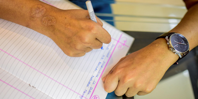 Nőiesebbé vált a férfi karja, miután átültették egy női testre