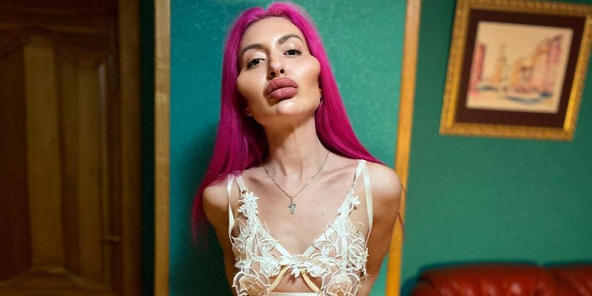 Saját arcát injekciózza az ukrán plasztikrém, Anastasiia Pokreshchuk - Videó