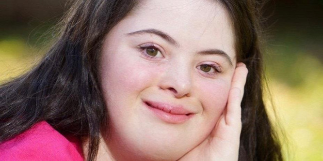 A brit Glamour első Down-szindrómás címlaplánya retusálás nélkül tündököl a borítón - Fotó