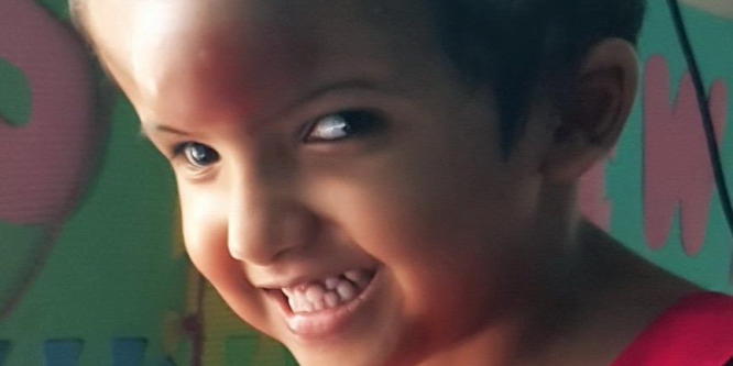 A bangladesi ikrek műtétsorozatának végső nagy állomásán van túl a magyar orvoscsapat