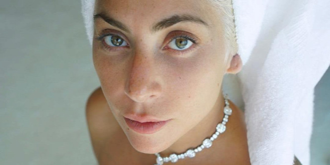 Szívszaggató sorokkal üzent Lady Gaga meglőtt kutyasétáltatója - Fotó