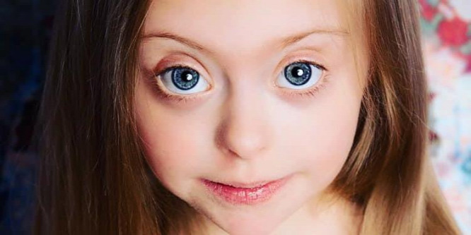 Profikat megszégyenítően pózol a kamera előtt Connie, a Down-szindrómás kislány - Fotó