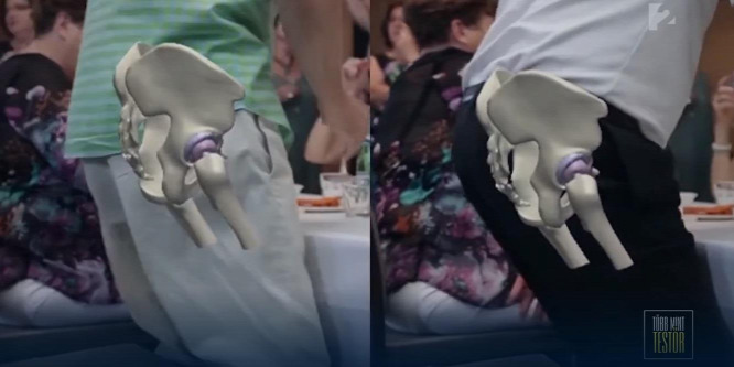 Új technológia a csípőműtétekben: vágás nélkül, kevesebb fájdalommal végezhetők az operációk