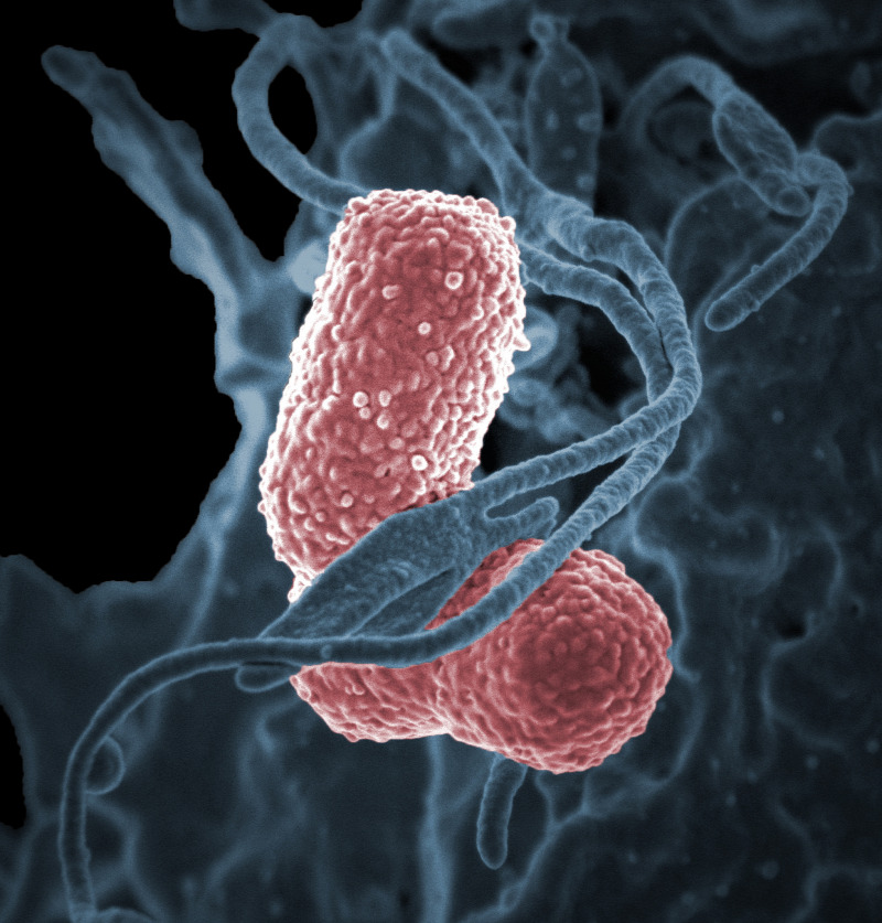 klebsiella pneumoniae baktériumok méregtelenítő fogyókúra